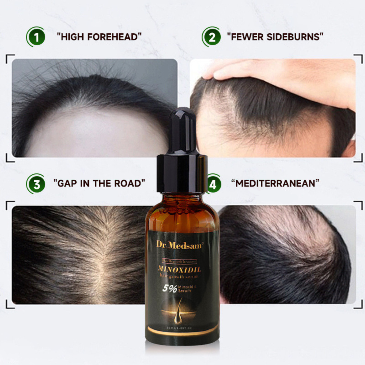 Cross-Border Minoxidil Hair Growth Solution 5% – 30ml