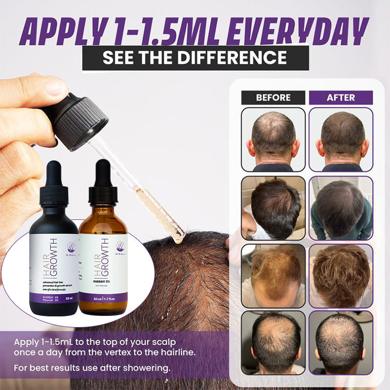 RU 5% Minoxidil 58841 Hair Growth Serum – DHT Blocking Essence