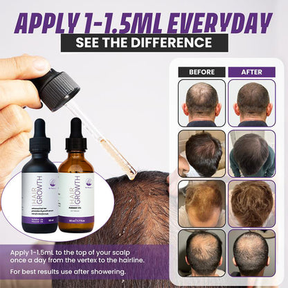 RU 5% Minoxidil 58841 Hair Growth Serum – DHT Blocking Essence