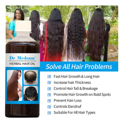 Dr.Medsam Indian Herbal Hair Thickening & Scalp Nourishing Oil 100ml