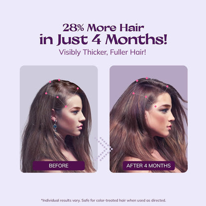 5% Minoxidil Hair Growth Solution & Foam – Dual Action 60ml x2